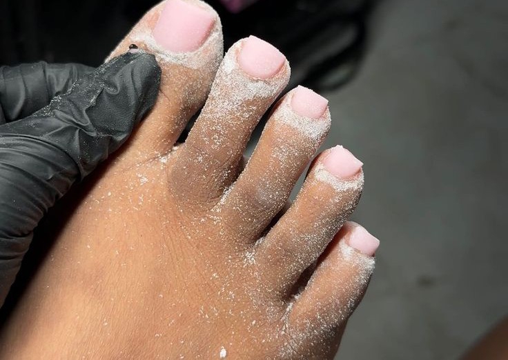 Overlay on all toes w/gel/Refill