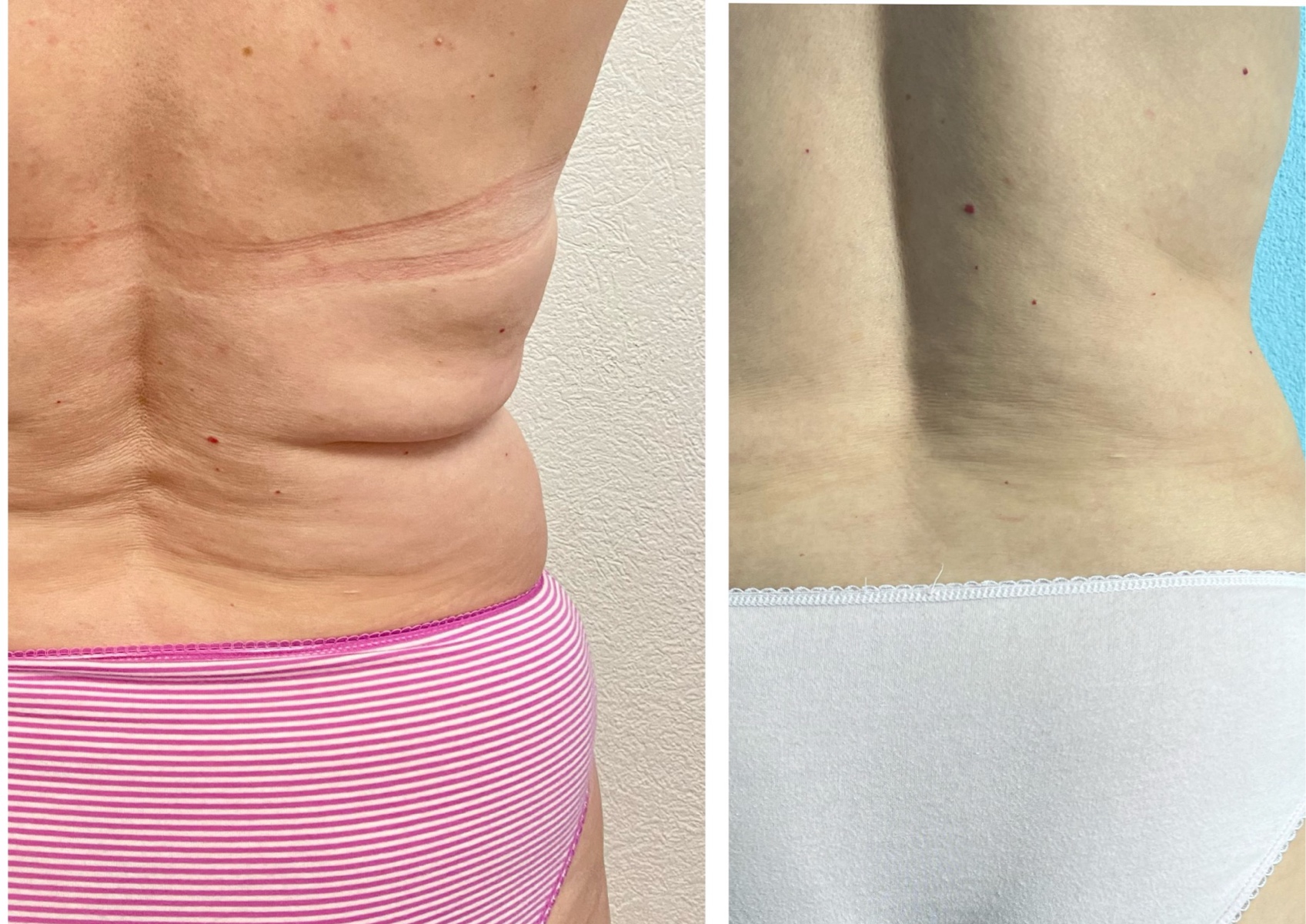 Power Massage (2 Körperzonen)