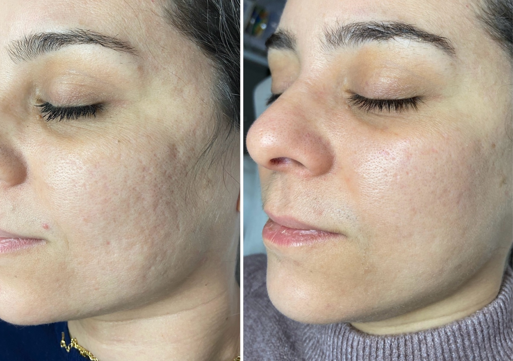 Peeling aus dem Toten Meer (Rose de mer)