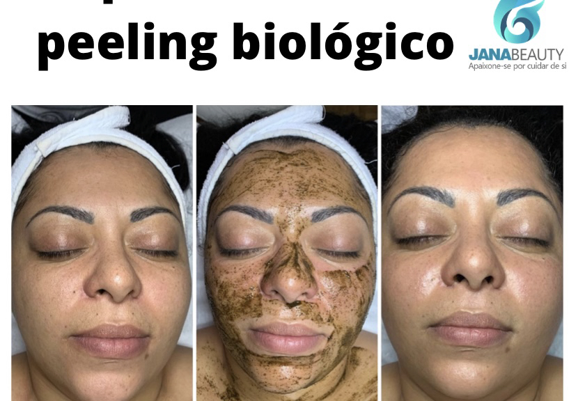  Tiefenreinigung der Haut Deluxe