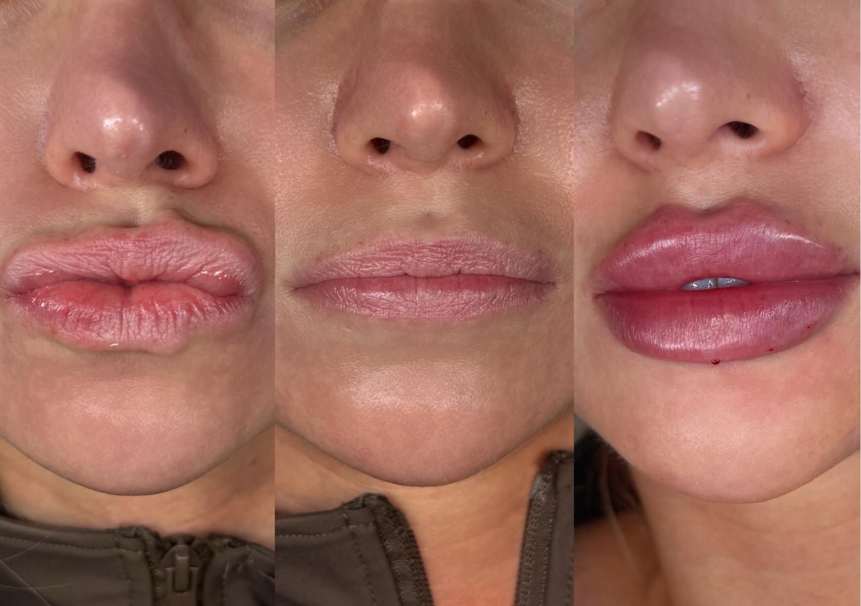 Dissolve & Russian Refill Package