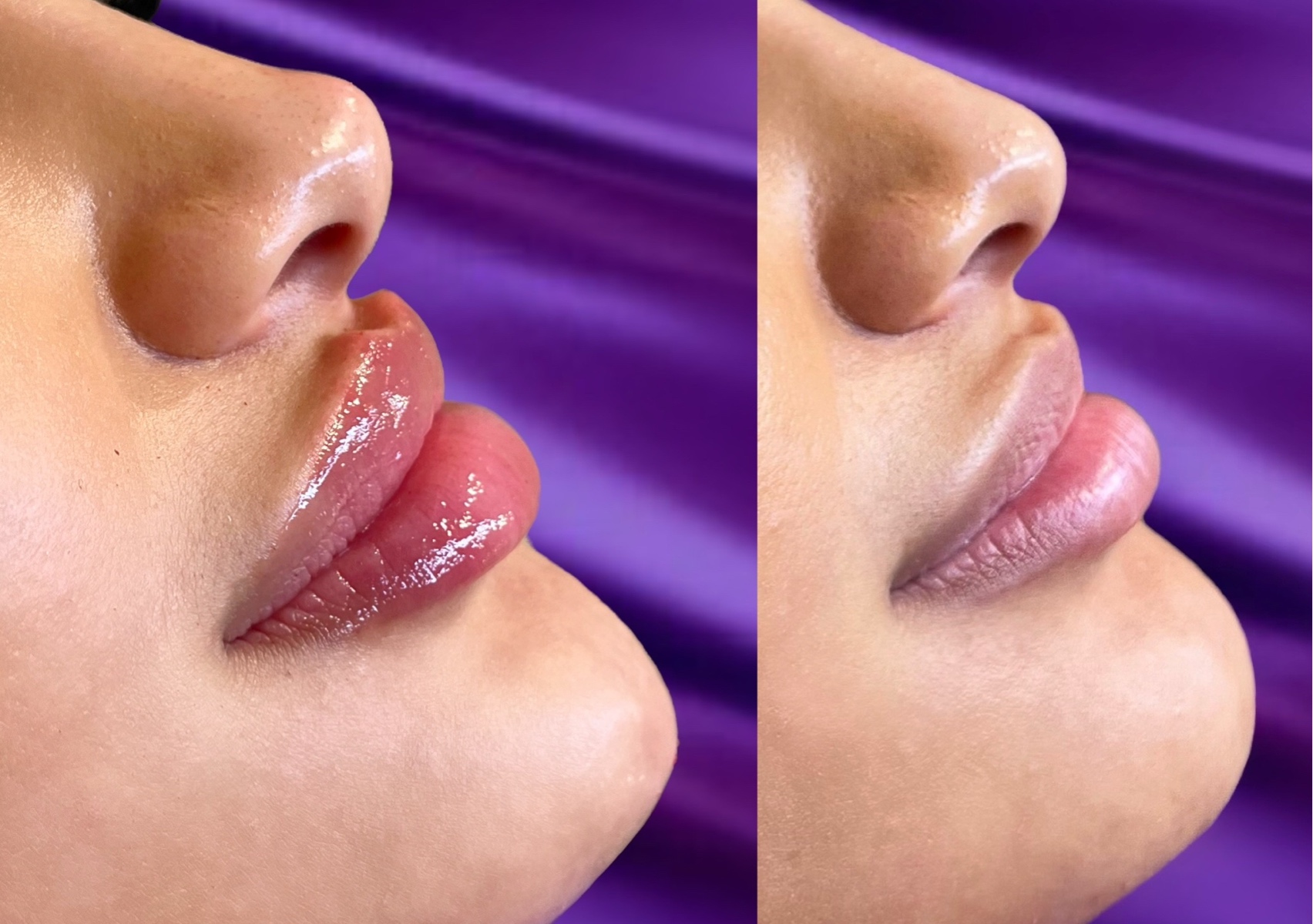 3.3ml Facial Balancing Package 