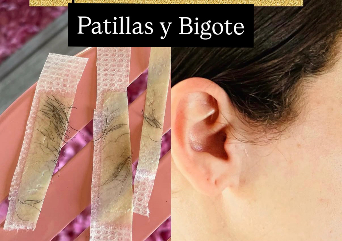 Epilacion de rostro