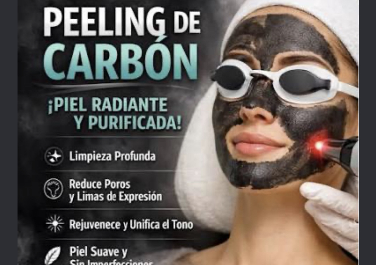 Carbon Peeling