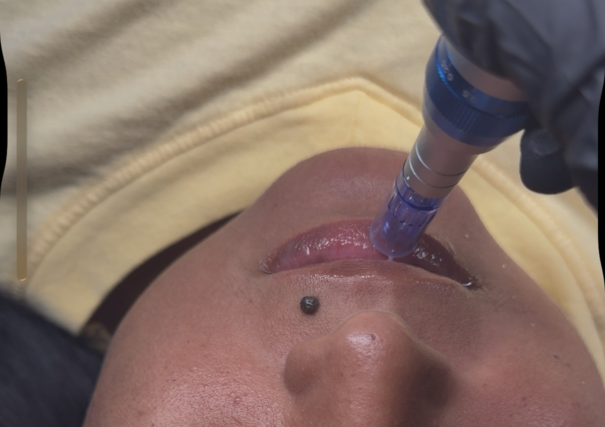  Hidratacion Labial