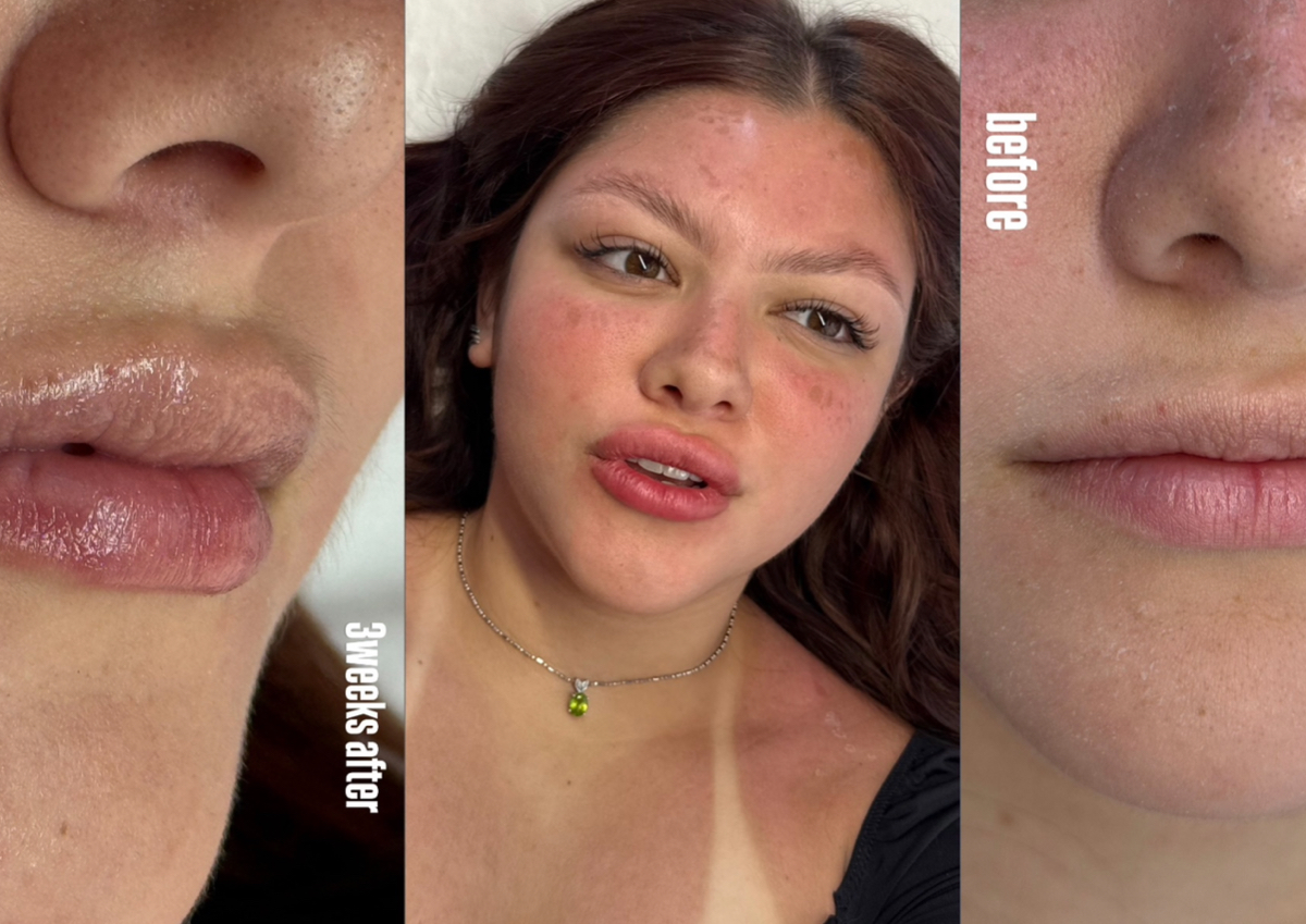 Hidratación labial