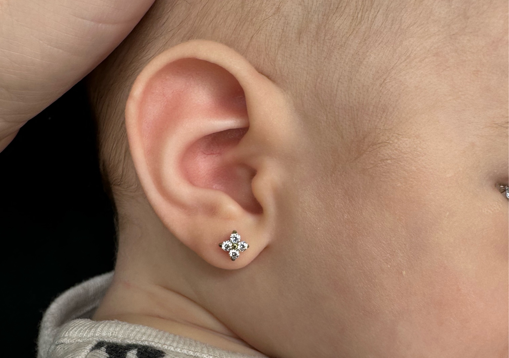 Baby’s Lobes with Numbing