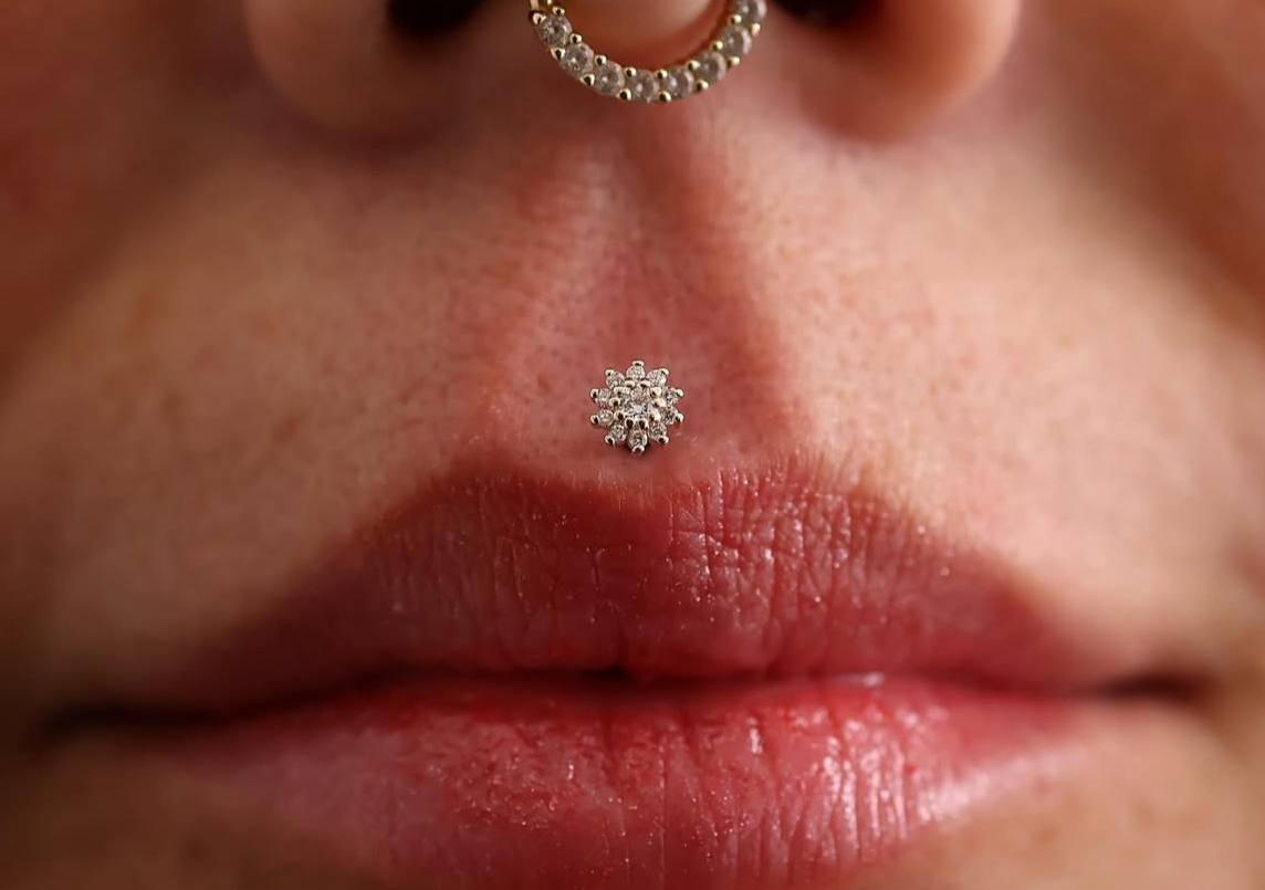 PHILTRUM