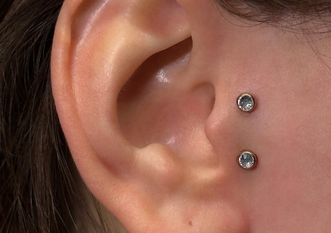 Surface Tragus (1/3)