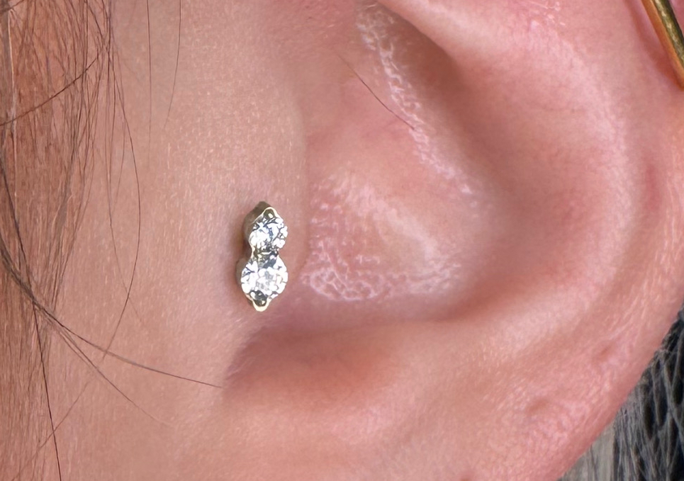 Tragus