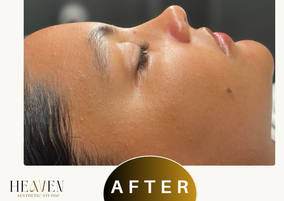 Clear Me Up Facial (adolecentes)