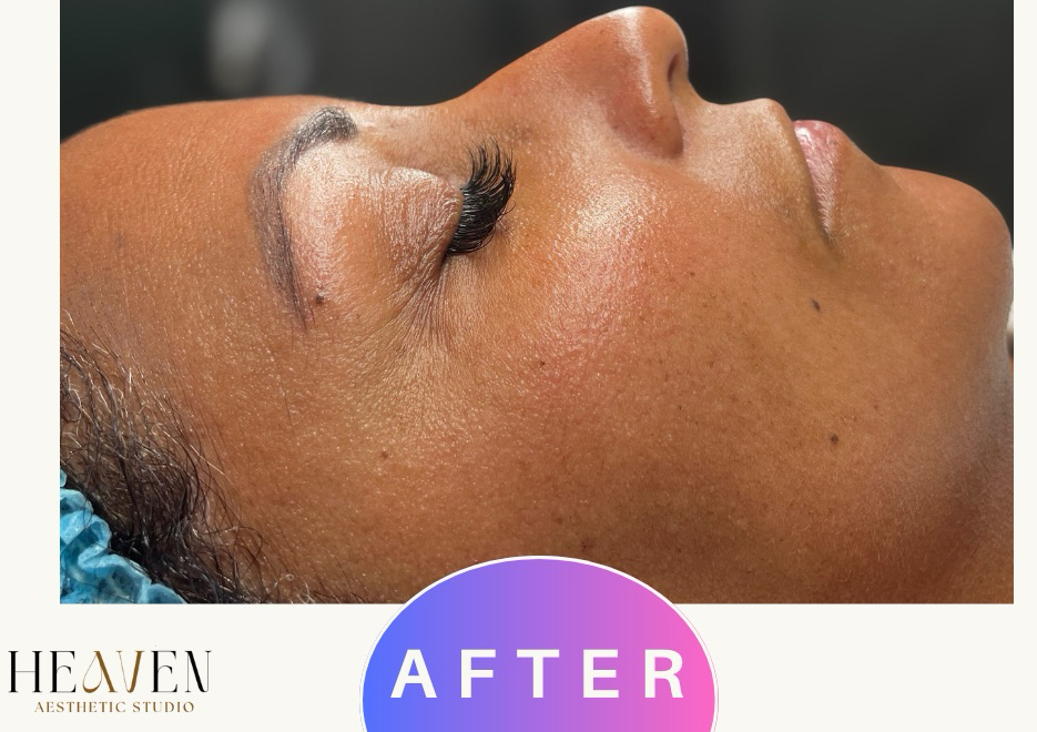 Oxy Heaven Facial