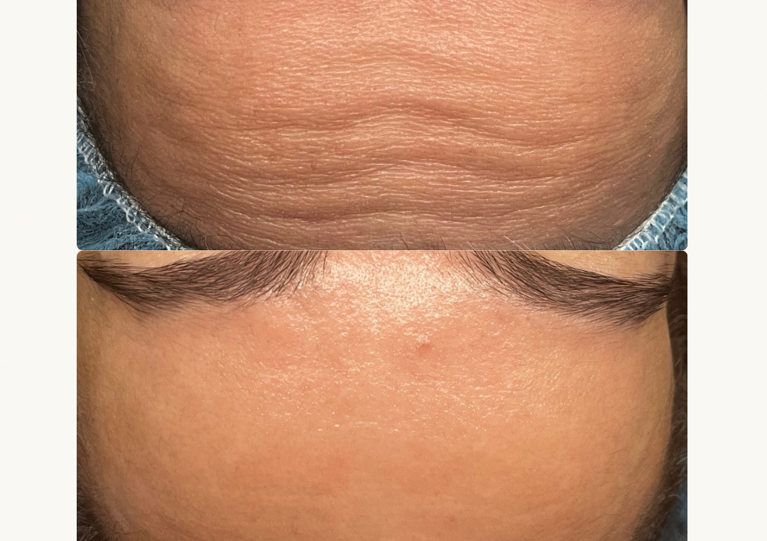 Heaven Collagen Repair