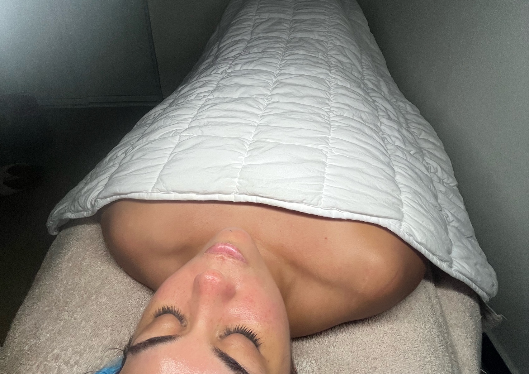 Hydrodermabrasion Facial