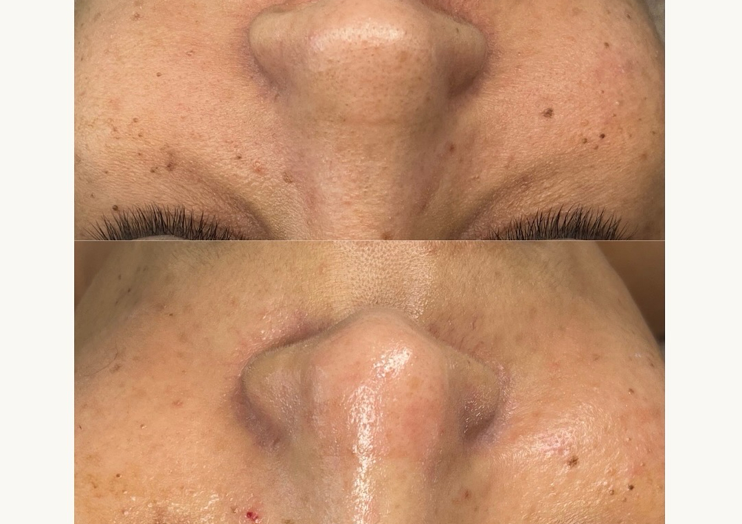 Facial Limpieza Profunda (masaje cuello y escote)