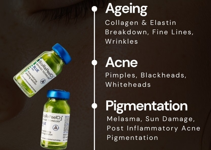 BioRePeel with Microneedling 