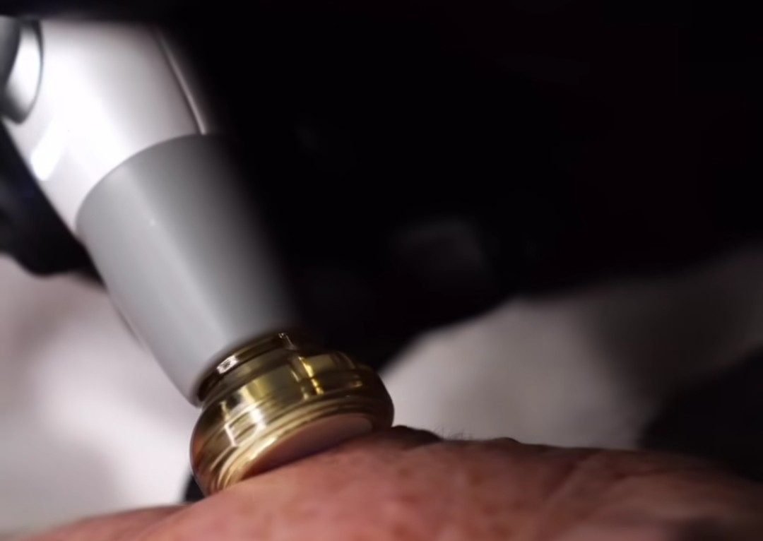 Jet Plasma follow-up treatment: Face only