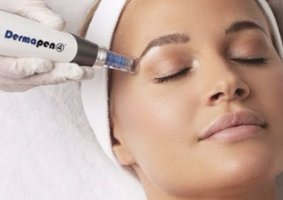 Dermapen microneedling FACE ONLY with mask