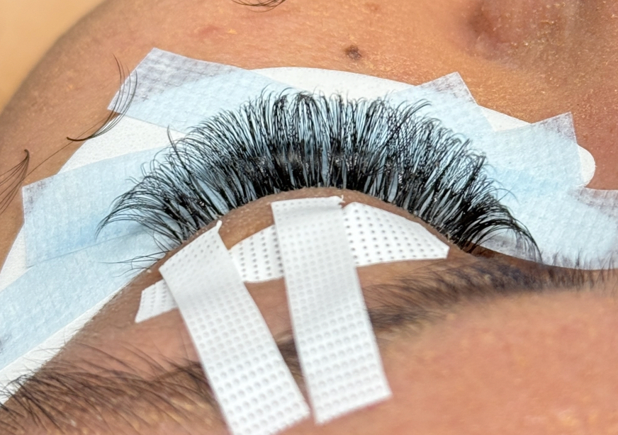 2 Week Fill (8-14days)