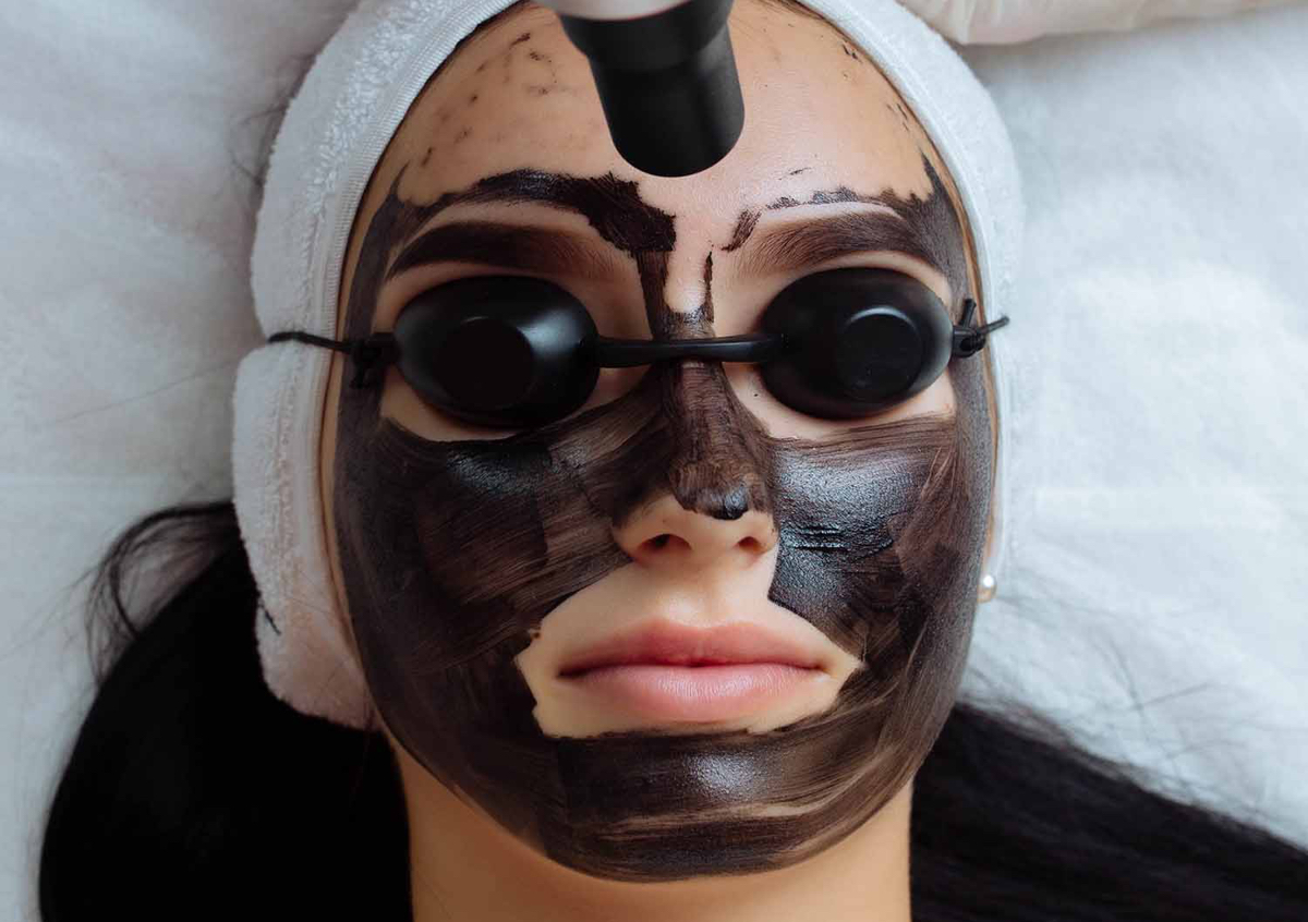 Hollywood Carbon Facial – Face