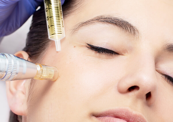 Face Mesotherapy