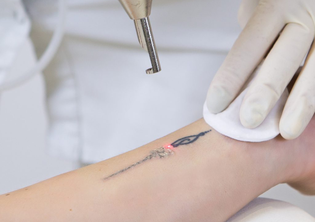 Very Small Tattoos (< 2 cm)