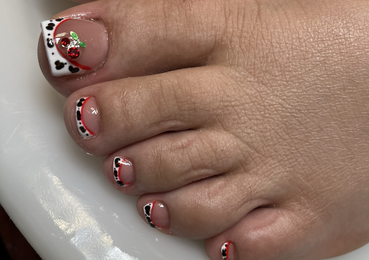 💎 Big Toe Reconstruction (2 Toes) 