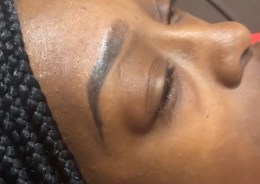 Brow Enhancement 