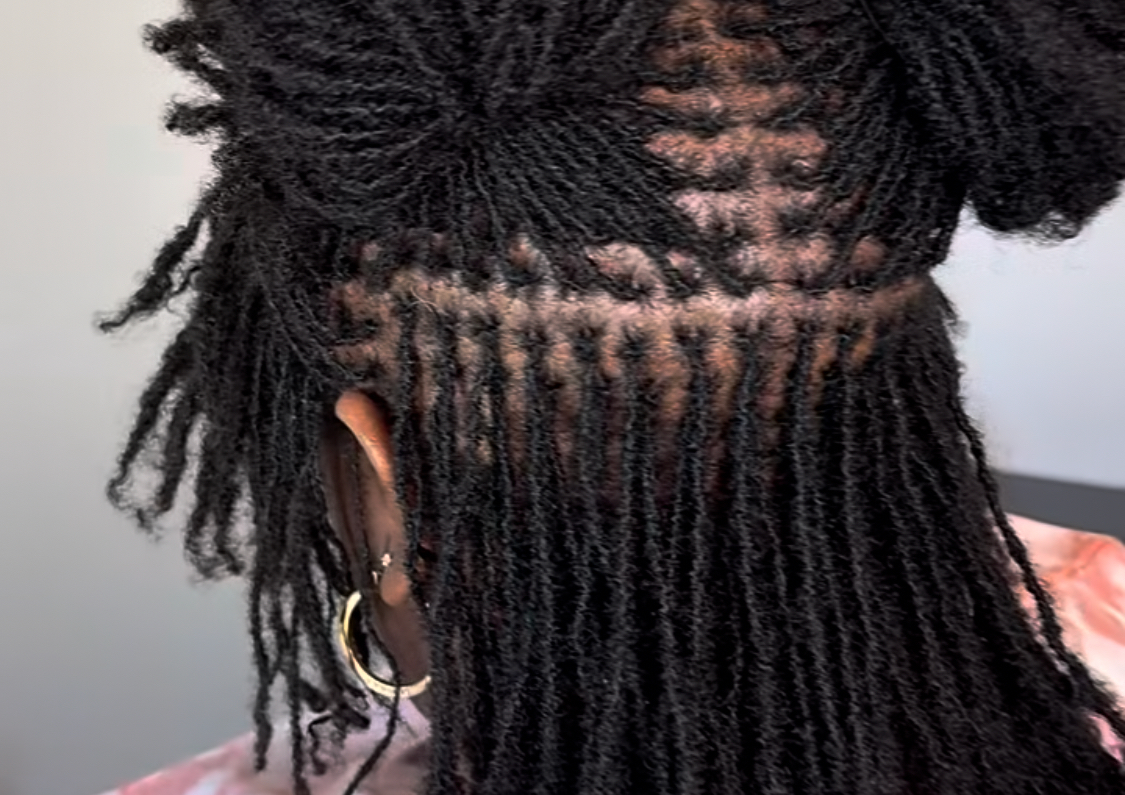 Microlocs retightening 4-6 weeks