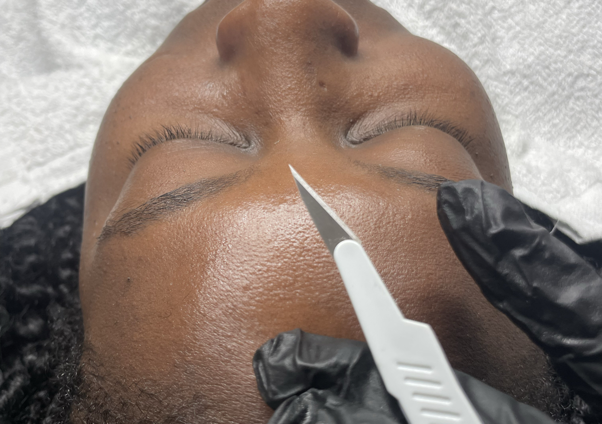 Dermaplaning Facial