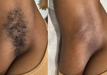 Just the Essentials (Underarm Wax+ Half Leg Wax)