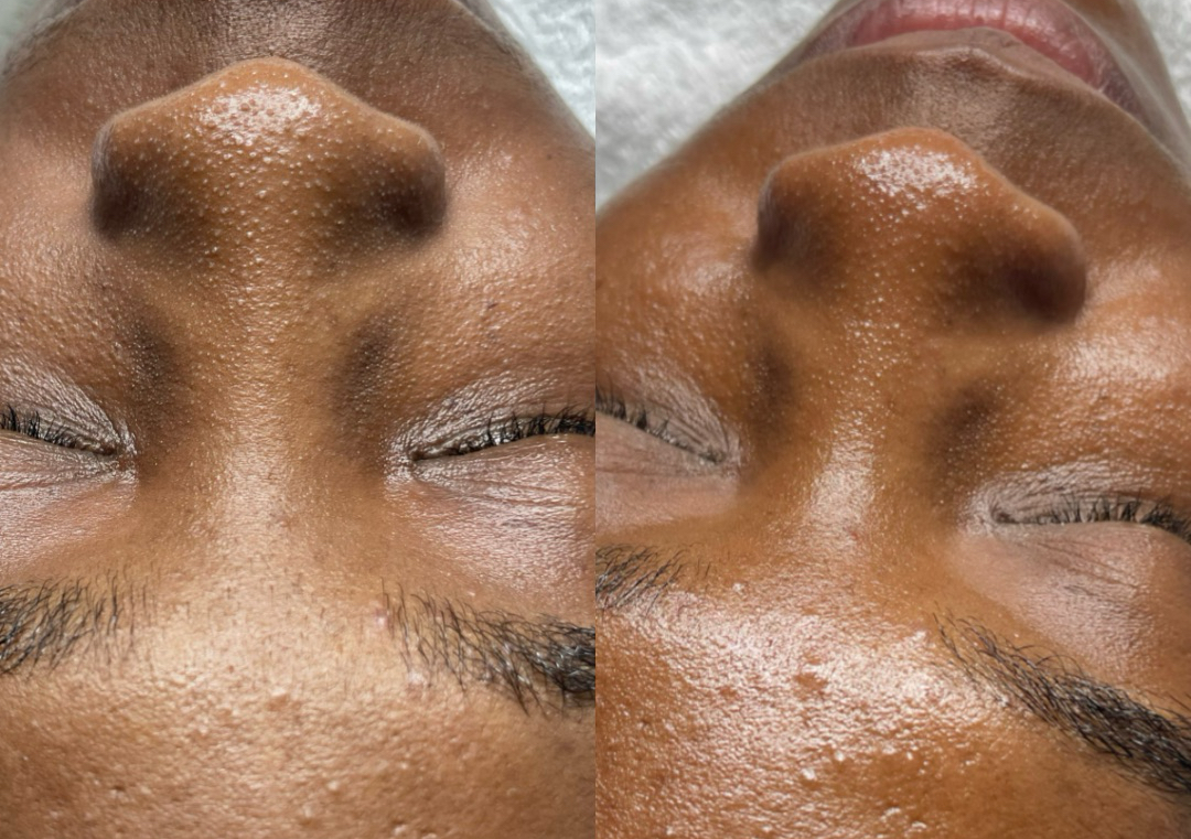 Glow Reset Facial