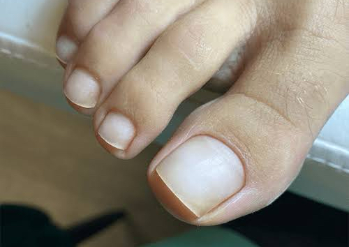 NO POLISH- Classic Express