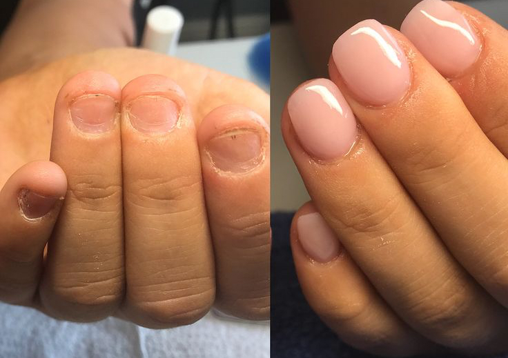 Acrylic Overlay Manicure 