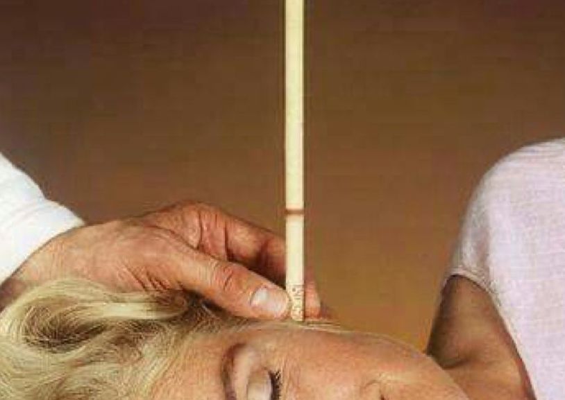 Hopi ear Candling