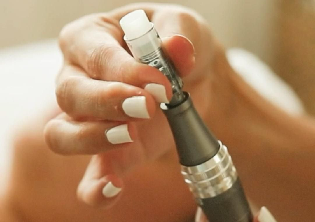 Tratamiento Microagujas 