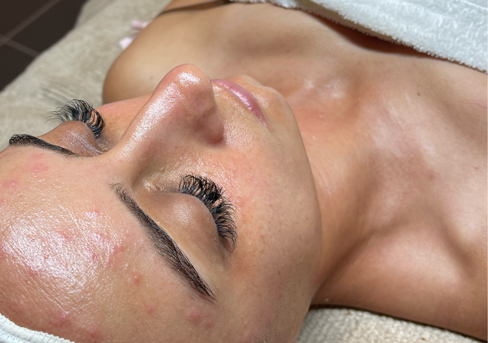 Limpieza Facial Profunda 