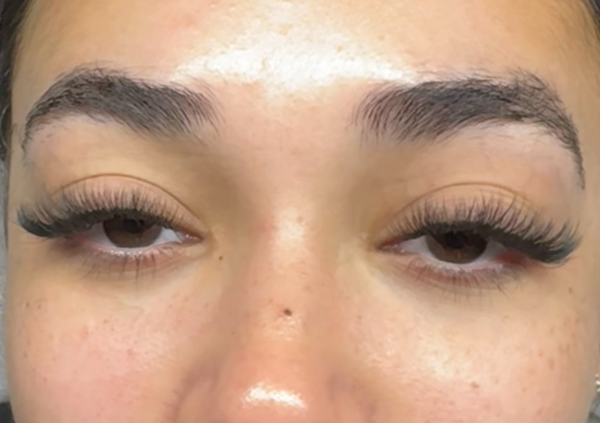 Classic Deluxe Refill