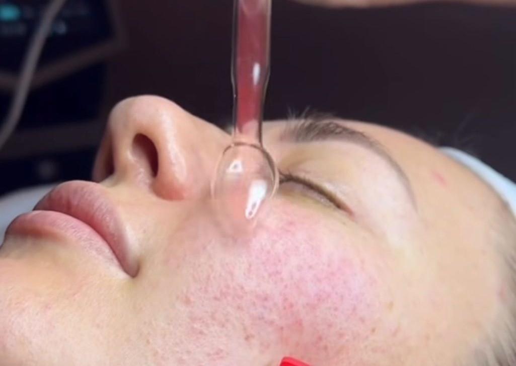 Facial for Men and Women
