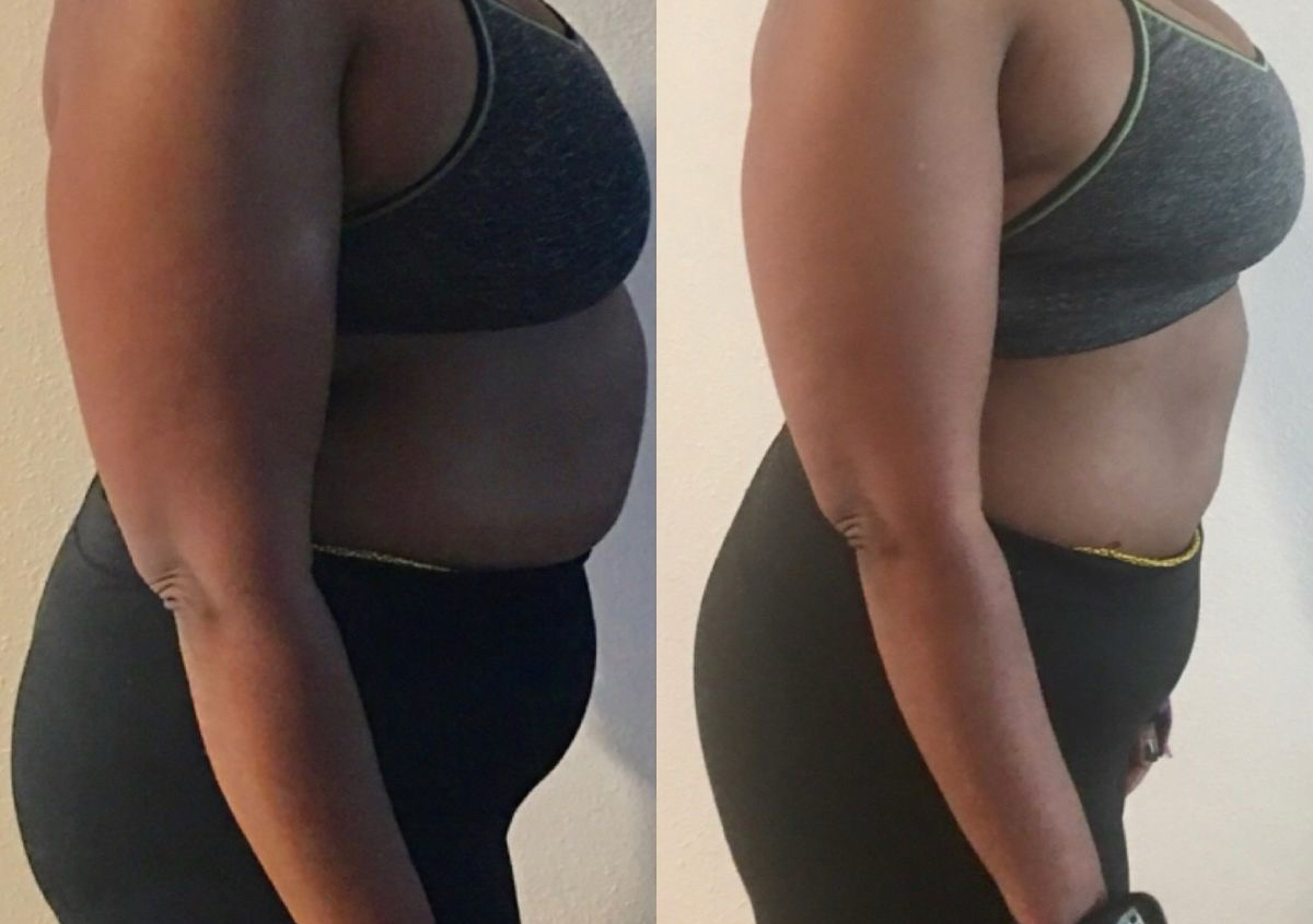 Stomach Reduction (cavi- lipo). 60 mins.