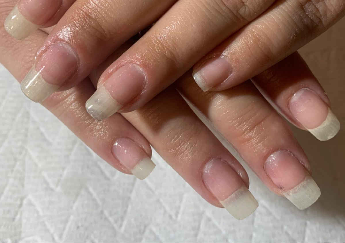 Acrylic Removal (My Work)