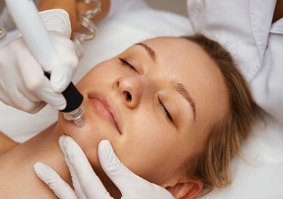 Delux Facial Microdermabrasi, Oxygen Mesotherapy, Cooling Treatments Included (Treatment every 3-4 weeks $85)