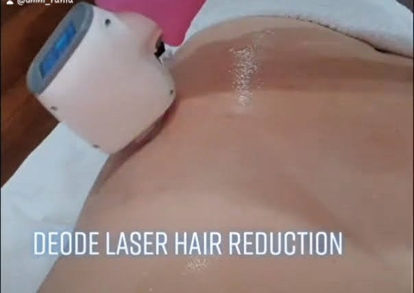 Laser hair reduction - Back- Shoulders-neck