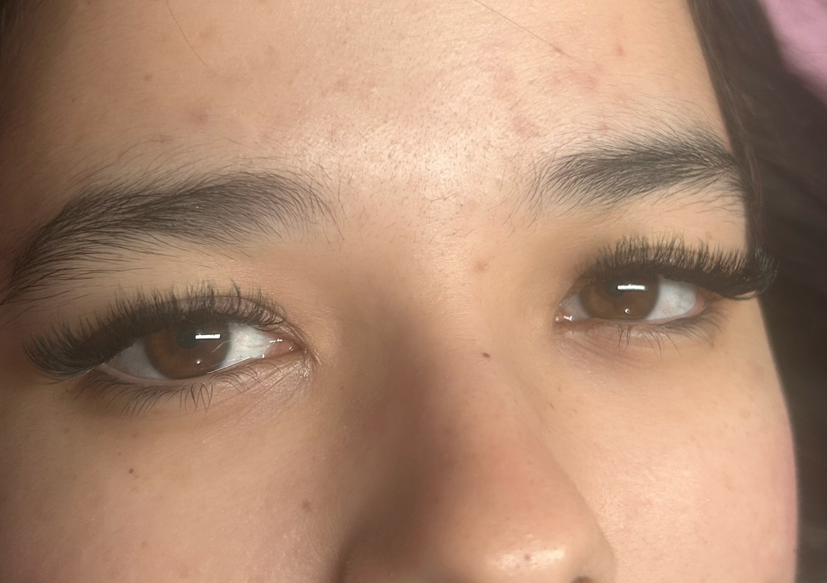 Soft volumen full set