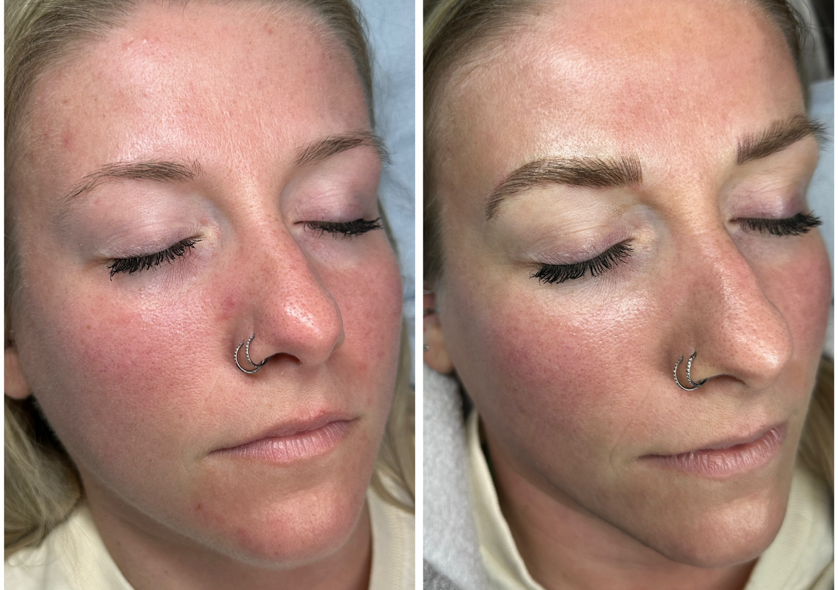 Microbladed Brows (initial)