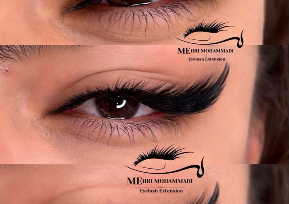 Extensii de gene Curbura L si D in fata 