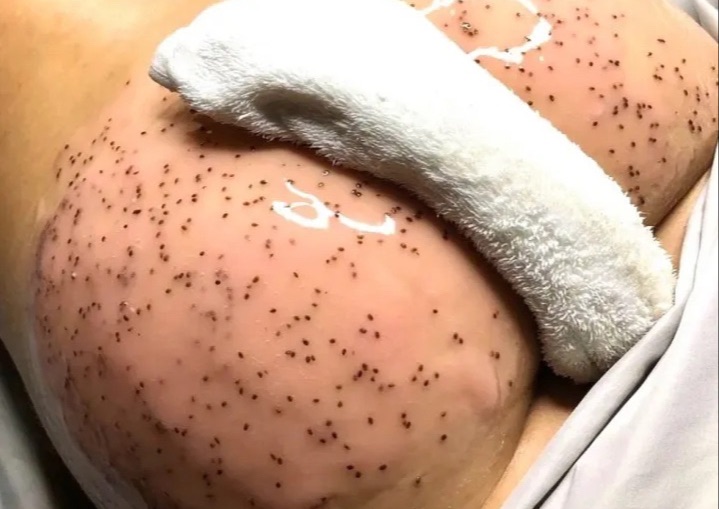 Cheeky Facial 🍑 (Butt Cheeks)