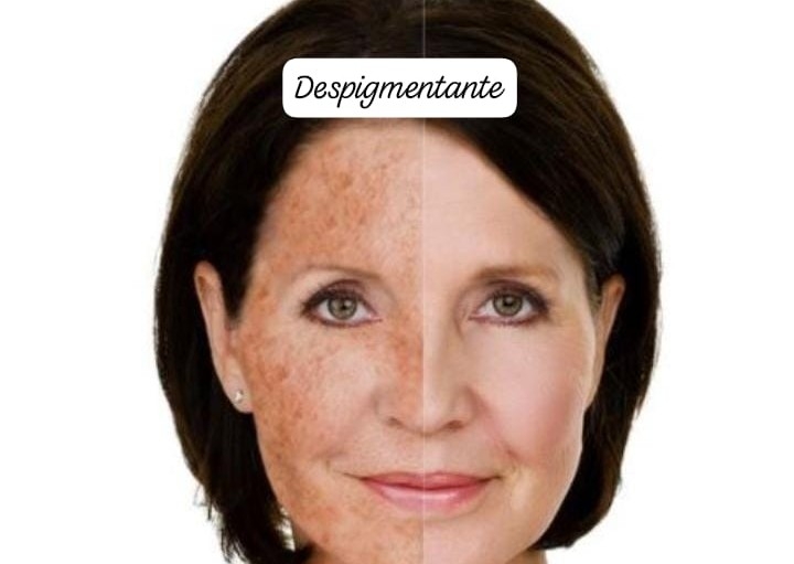 Tratamiento despigmentante/ aclarante Facial