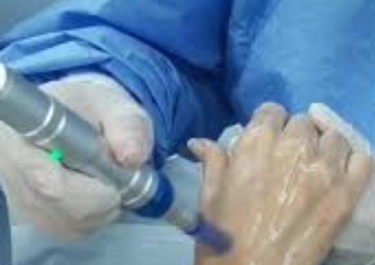 Rejuvenecimiento de Manos