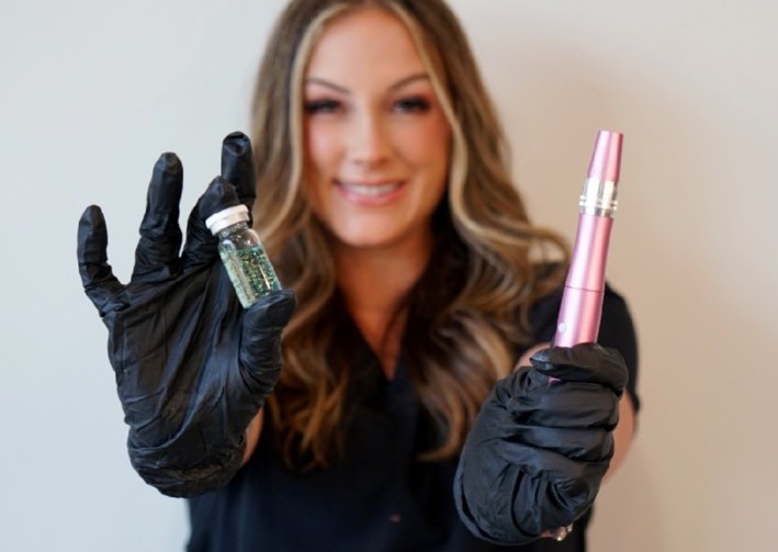 Microneedling 